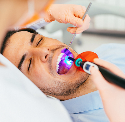 Dentist performing composite bonding procedure